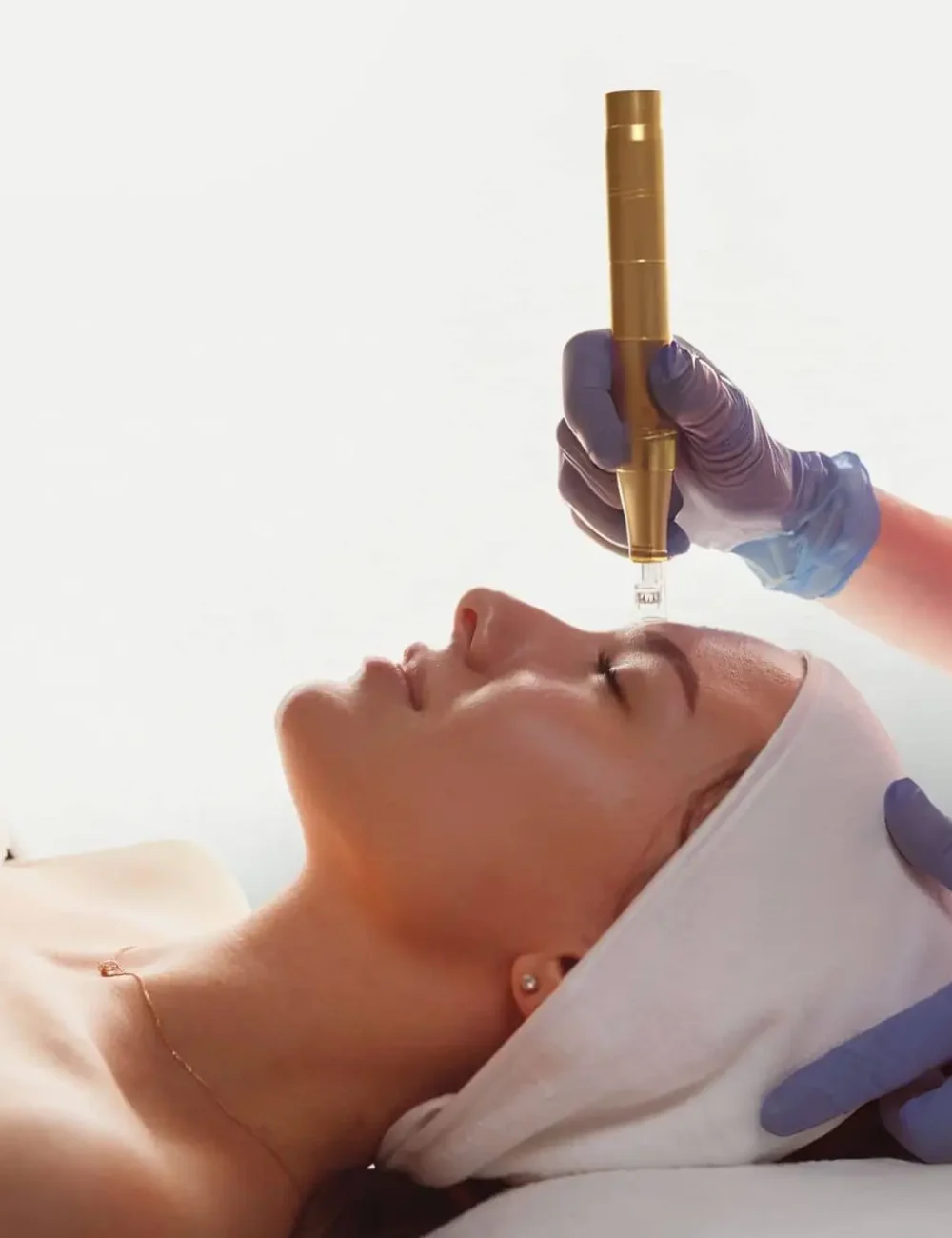 dermapen/microneedling/skinpen dermapen/microneedling/skinpen